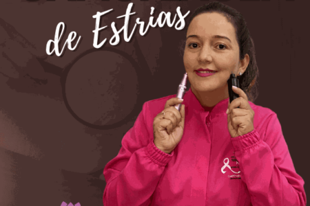 Camuflagem de Estrias – Érika Martini